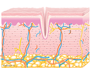 Image of Untreated Skin